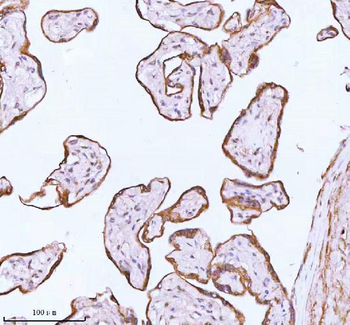 ME3 Antibody