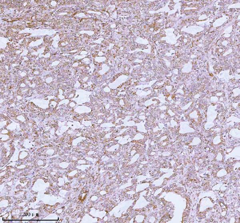 ME3 Antibody