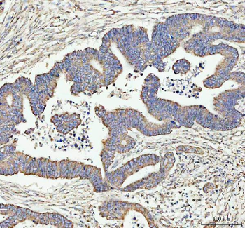 LARG/ARHGEF12 Antibody