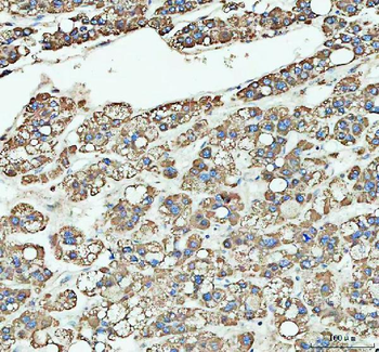 LARG/ARHGEF12 Antibody