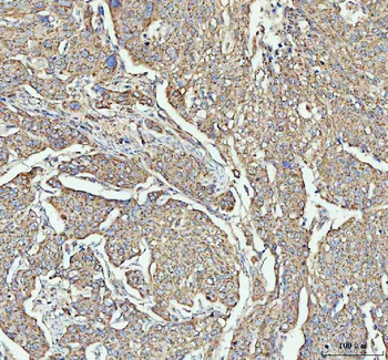 LARG/ARHGEF12 Antibody