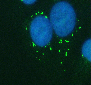 CAPN5 Rabbit Polyclonal Antibody
