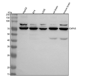 CAPN5 Rabbit Polyclonal Antibody