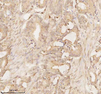 ARHGEF7 Antibody