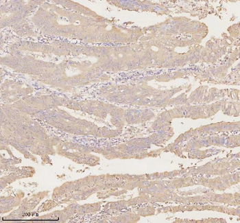 ARHGEF7 Antibody