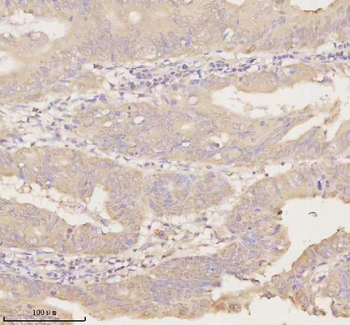 ARHGEF7 Antibody