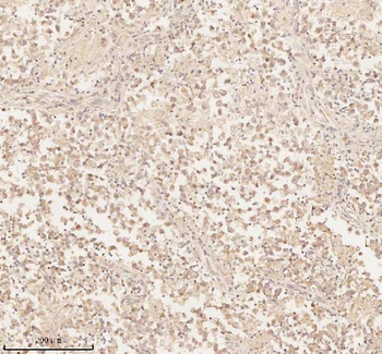ARHGEF7 Antibody