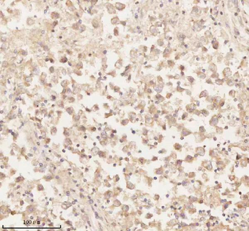 ARHGEF7 Antibody