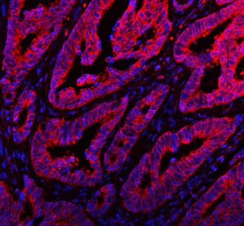 ARHGEF7 Antibody