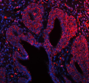 ARHGEF7 Antibody