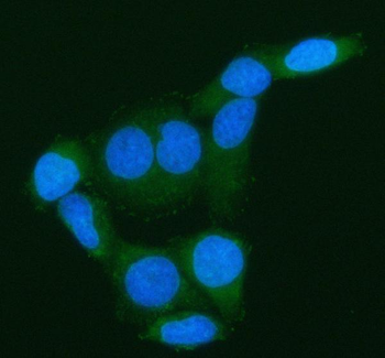 ARHGEF7 Antibody