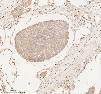 ARHGEF7 Antibody