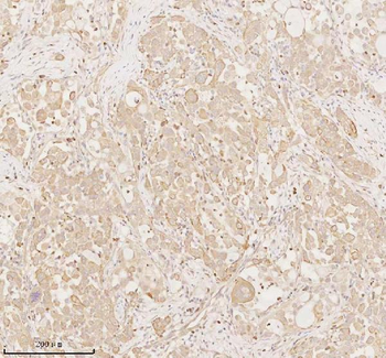 ARHGEF7 Antibody