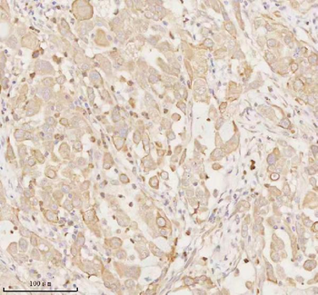 ARHGEF7 Antibody