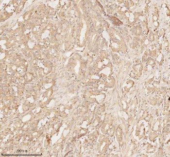 ARHGEF7 Antibody