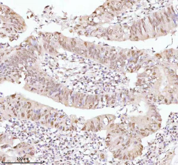 ASH2L Antibody