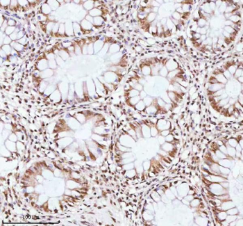 ASH2L Antibody