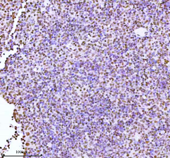 ASH2L Antibody
