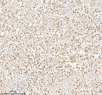 ASH2L Antibody