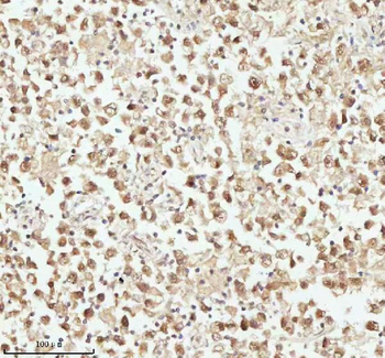 ASH2L Antibody