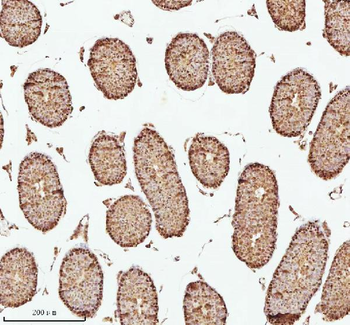 ASH2L Antibody