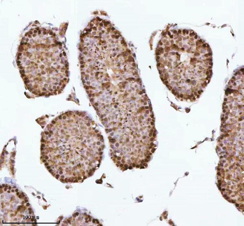 ASH2L Antibody