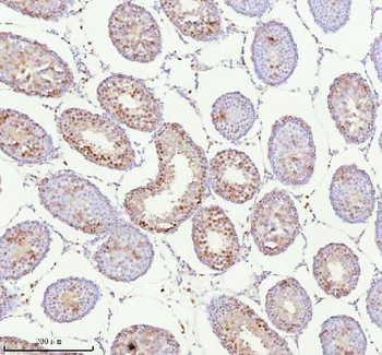 ASH2L Antibody