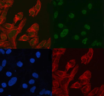 ASH2L Antibody