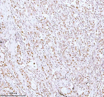 ASH2L Antibody