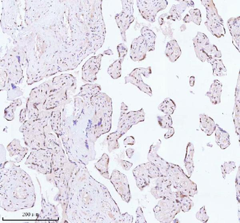 ASH2L Antibody