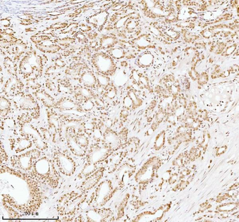 ASH2L Antibody