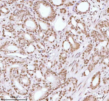 ASH2L Antibody