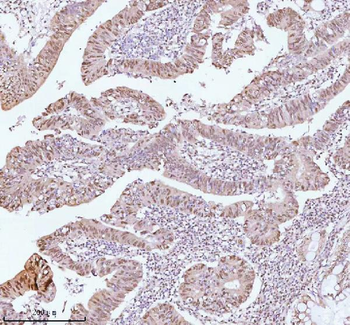 ASH2L Antibody
