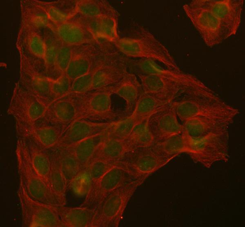 ABL1 Rabbit Polyclonal Antibody