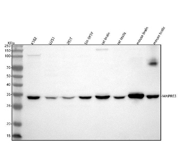 EB3/MAPRE3 Rabbit Polyclonal Antibody