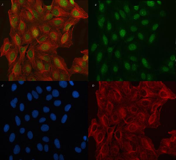 TNRC6C Rabbit Polyclonal Antibody
