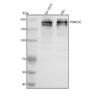 TNRC6C Rabbit Polyclonal Antibody