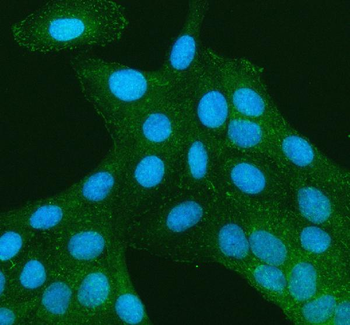 TNS3 Antibody