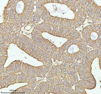 TNS3 Antibody