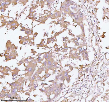 TNS3 Antibody