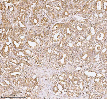 TNS3 Antibody