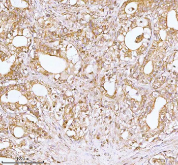 TNS3 Antibody