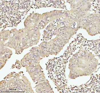PITHD1 Antibody