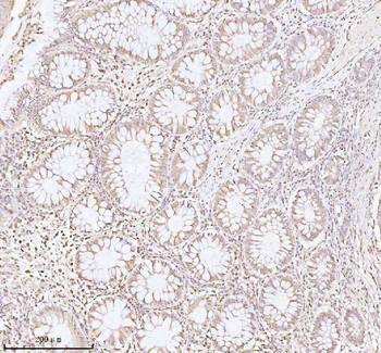 PITHD1 Antibody