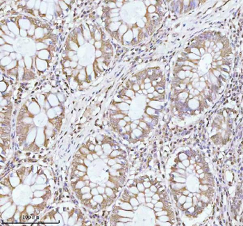 PITHD1 Antibody