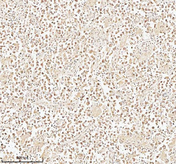 PITHD1 Antibody