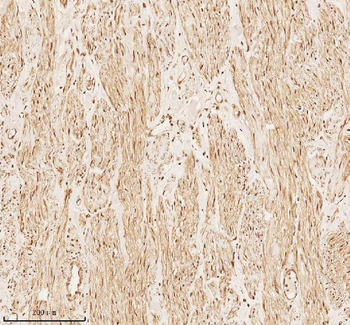 PITHD1 Antibody