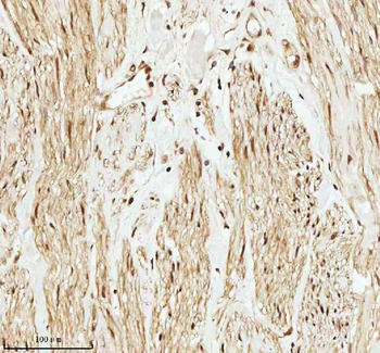 PITHD1 Antibody