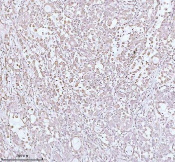 PITHD1 Antibody