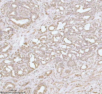 PITHD1 Antibody